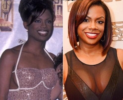A picture of Kandi Burruss before and after breast implants.
